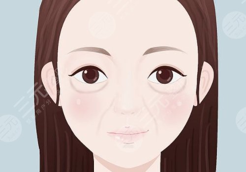 雙美膠原蛋白填充淚溝能維持多久？