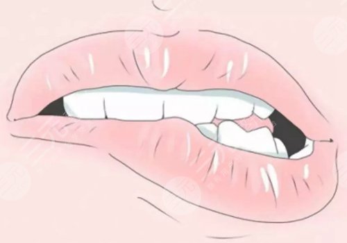 唇部老化的表現(xiàn)有哪些？改良方法有這些！