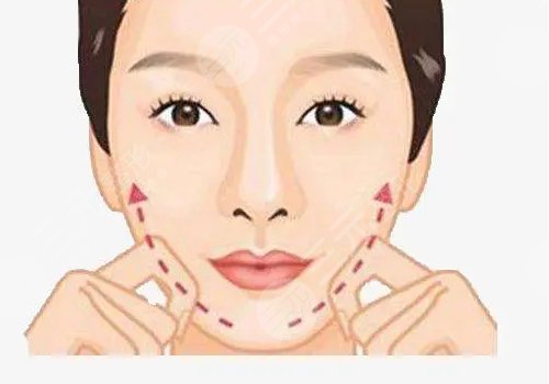 肉肉臉可以做什么醫(yī)美？