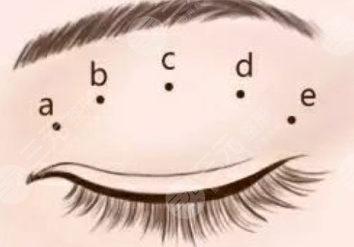 廣州可玉醫(yī)療美容醫(yī)院羅勇怎么樣？