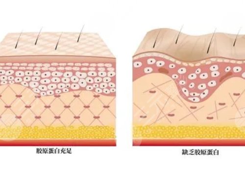 雙美膠原蛋白有幾種型號？