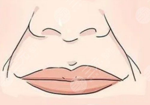 括號紋怎么去掉？怎么形成的？改良方式解讀！