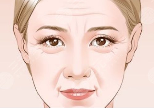 括號紋怎么去掉？怎么形成的？改良方式解讀！