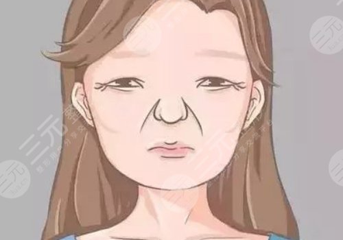 括號紋怎么去掉？怎么形成的？改良方式解讀！