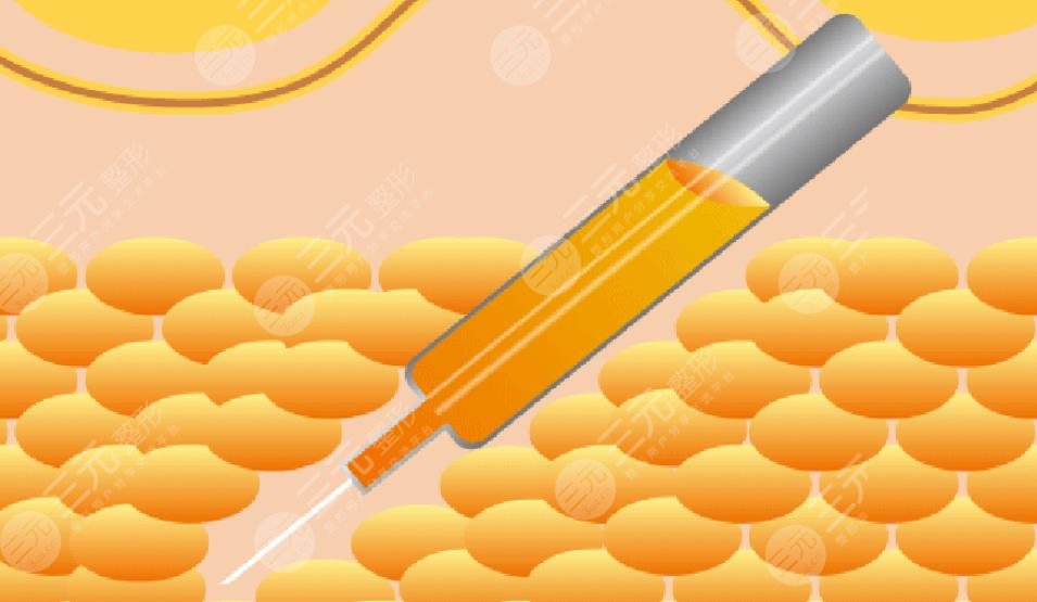 謝宏彬醫(yī)生擅長(zhǎng)項(xiàng)目