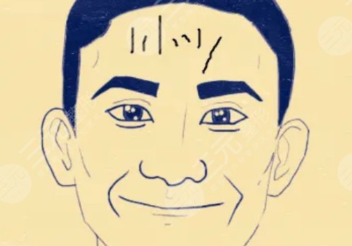 抬頭紋怎么去除有效男生？