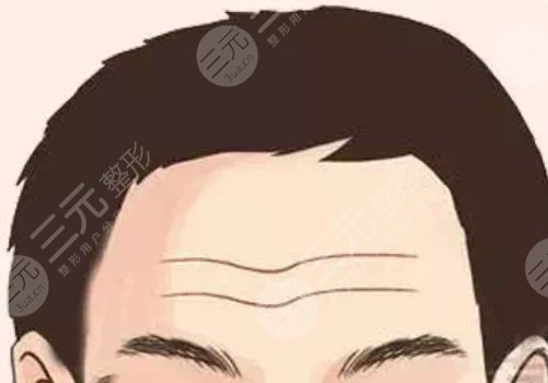 抬頭紋怎么去除有效男生？