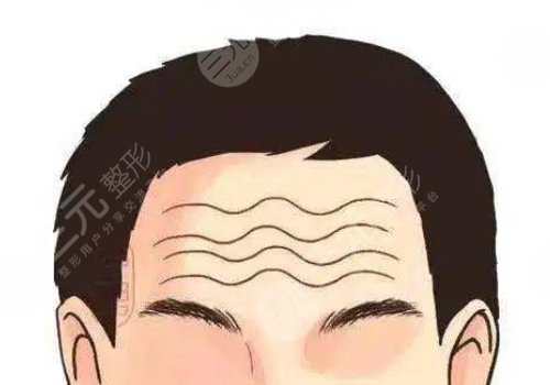 抬頭紋怎么去除有效男生？