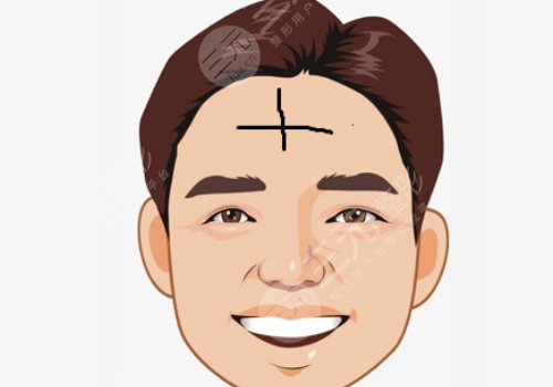 抬頭紋怎么去除有效男生？