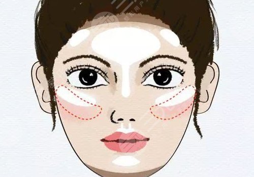 蘋果肌斷層有啥辦法解決？