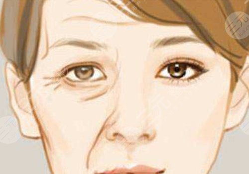 抬頭紋去除手術(shù)需要多少錢？