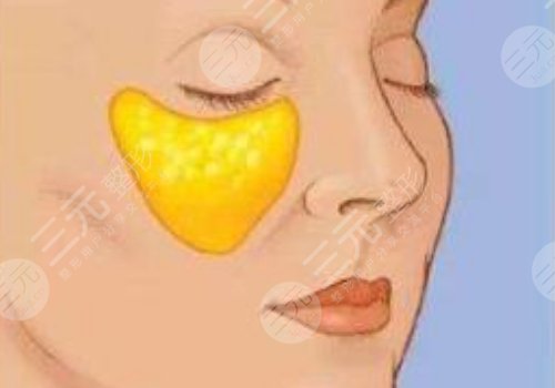 眼窩凹陷用什么填充好？