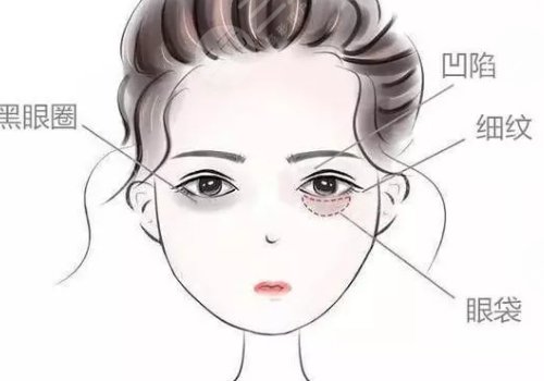 眼窩凹陷用什么填充好？