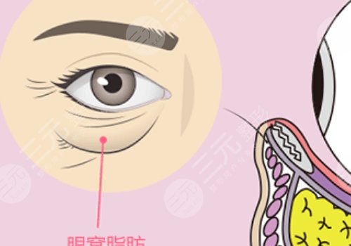 眼窩凹陷用什么填充好？