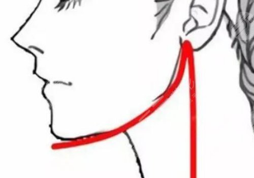 下頜線提升前后對比圖