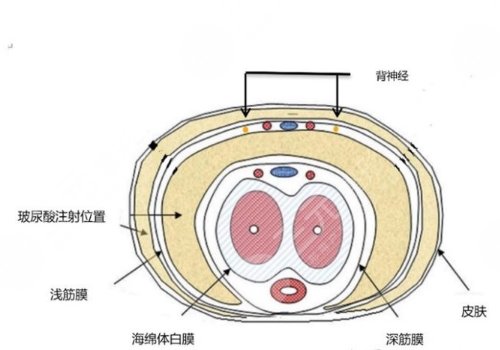 玻尿酸男性增大注射要多少錢？