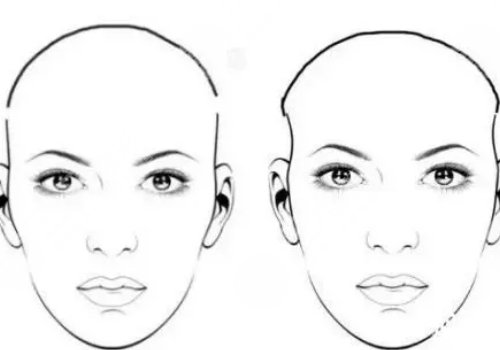 假體填充太陽凹大概多少錢？
