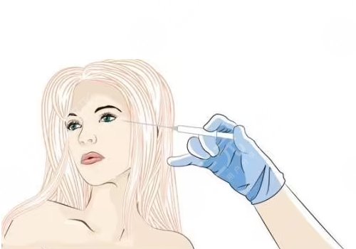 玻尿酸填充太陽凹大概多少錢？