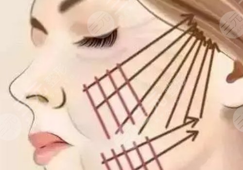 面部提升術(shù)的危害有什么？