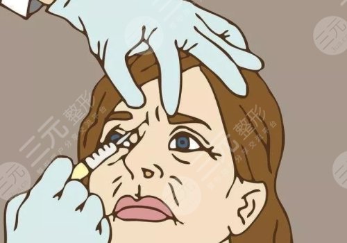 面部打玻尿酸哪里危險(xiǎn)大？