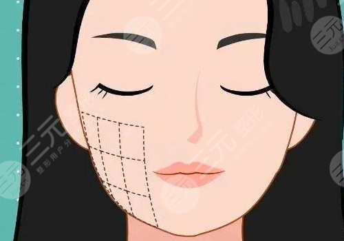 下頜提升針幾天有效果？