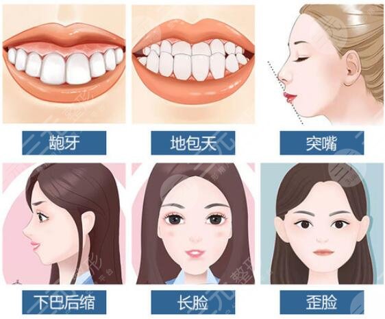 嘴凸法令紋重可以整形嗎？3種改良方案分享，醫(yī)美不盲目！