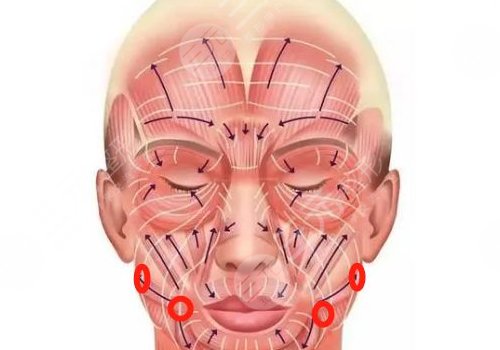 筋膜懸吊面部提升術(shù)保持多久？