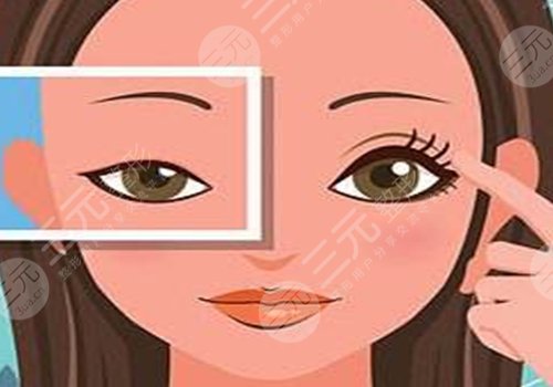 做眼部提拉手術(shù)能維持多久？