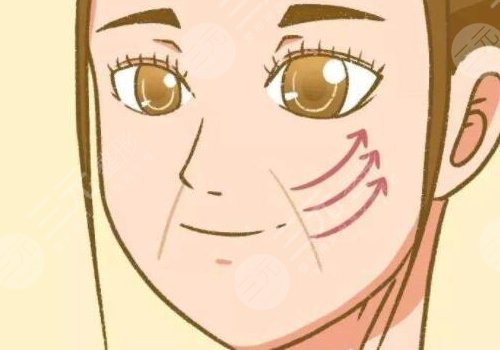 臉部提拉緊致手術(shù)多少錢(qián)？