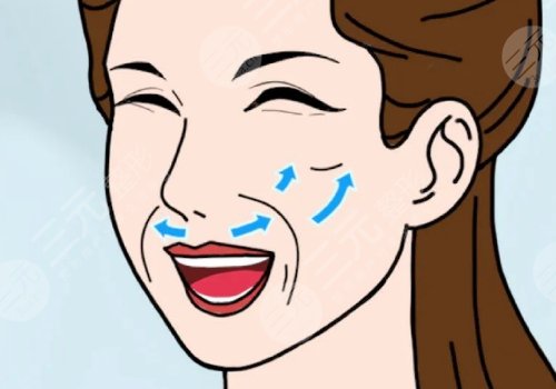 臉部提拉緊致手術(shù)多少錢(qián)？手術(shù)方式有哪些？多久能恢復(fù)？