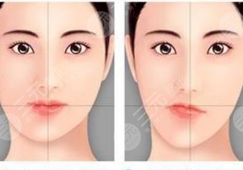 嘴巴歪整形大概多少錢？