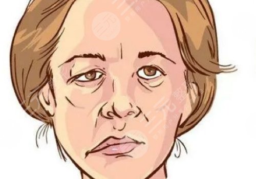 嘴巴歪整形大概多少錢？