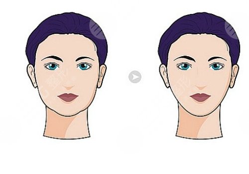 男生如何自然瘦臉？