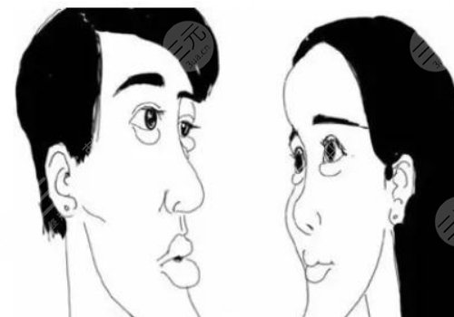 月亮臉矯正手術(shù)多少錢(qián)？