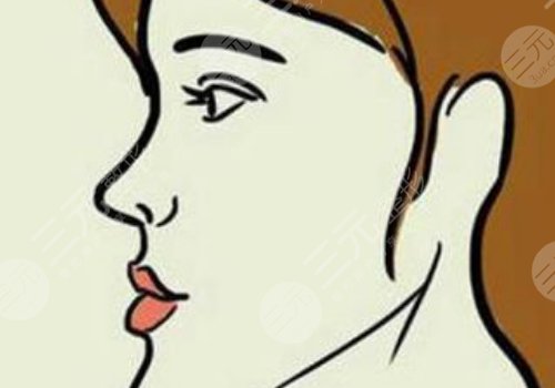 月亮臉矯正手術(shù)多少錢(qián)？