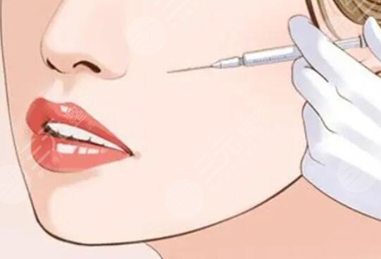唇部整形