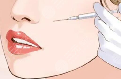 唇部整形