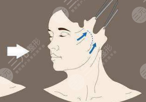 皮膚松弛怎么辦如何變緊致面部？