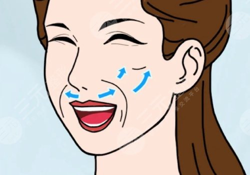 皺紋去除的好辦法是什么？