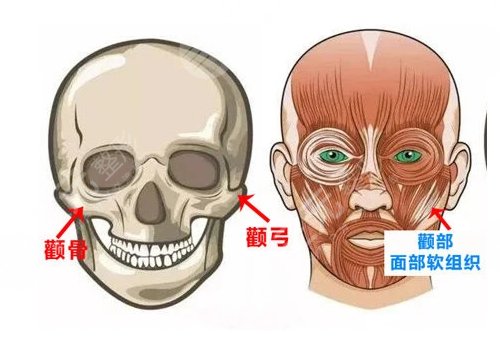 磨顴骨手術(shù)一般要多少錢？