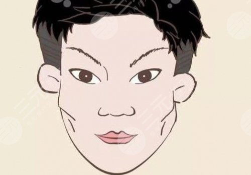 磨顴骨手術(shù)一般要多少錢？