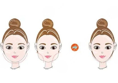 磨顴骨手術(shù)一般要多少錢？