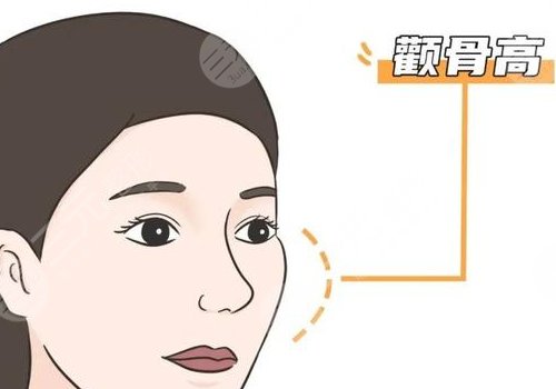 磨顴骨手術(shù)一般要多少錢？