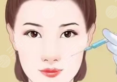 緊致提升針能保持多久？