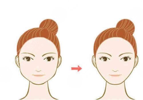 做完輪廓手術(shù)臉更大了怎么回事？