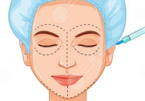 做完輪廓手術(shù)臉更大了怎么回事？