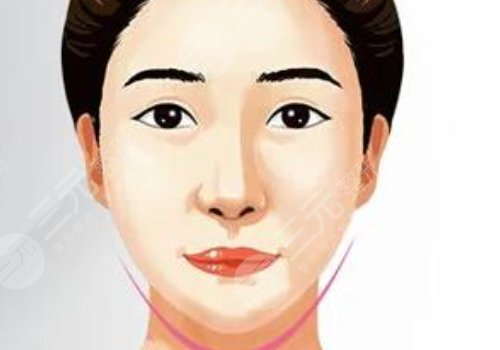 內(nèi)外輪廓固定做手術(shù)要多久？