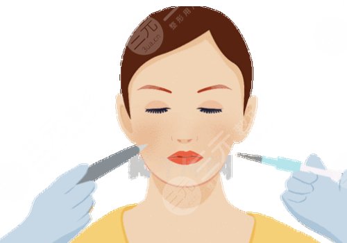 打了輪廓針多久可以懷孕