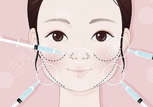 打了輪廓針多久可以懷孕