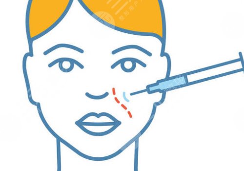 瑞藍玻尿酸打在哪個部位？